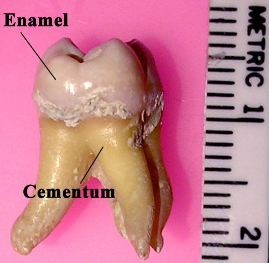 Cross-section of a molar tooth showing enamel, dentin, pulp chamber and root